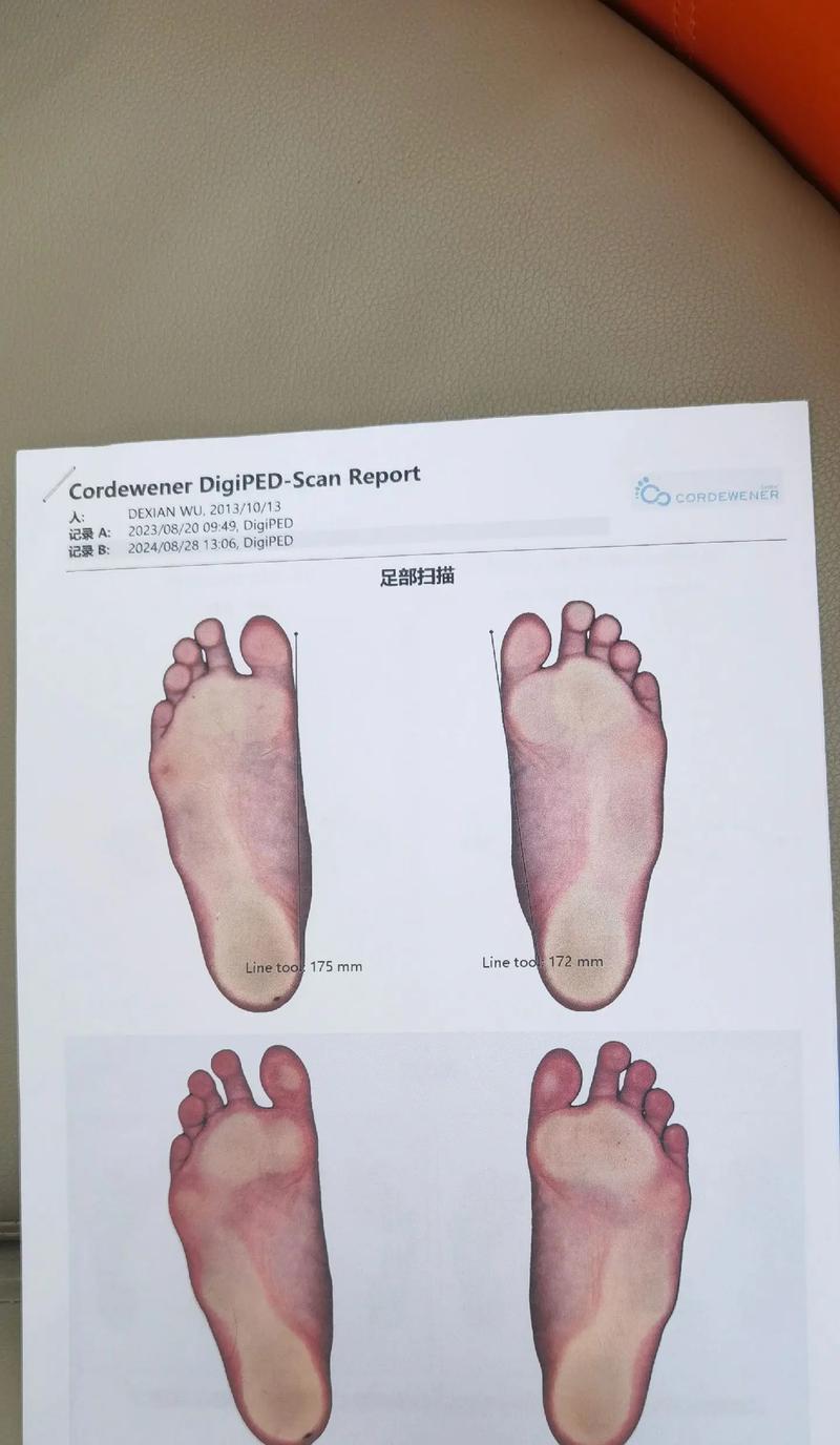 征途1代鞋垫子更换方法？更换后性能有何提升？-第3张图片-西柚游戏